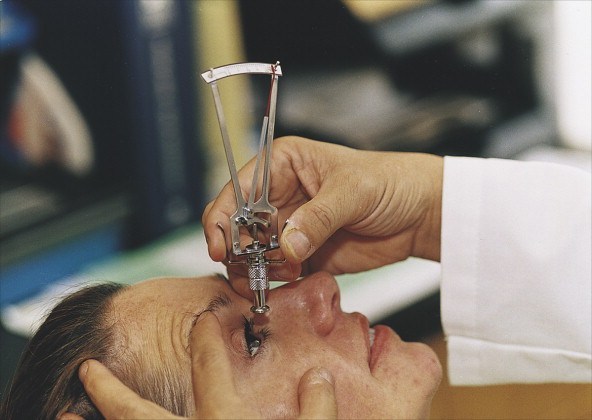 Glaucoma